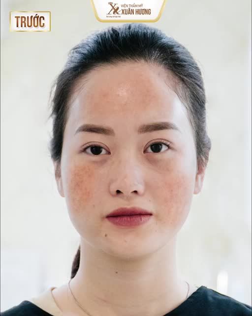 DA ĐẸP CŨNG CÓ CÁI "PHIỀN"