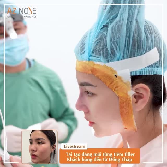 Từng t.iêm filler, dáng mũi của chị K.T. thay đổi thế nào sau khi nâng mũi cấu trúc - chỉnh vách ngăn?