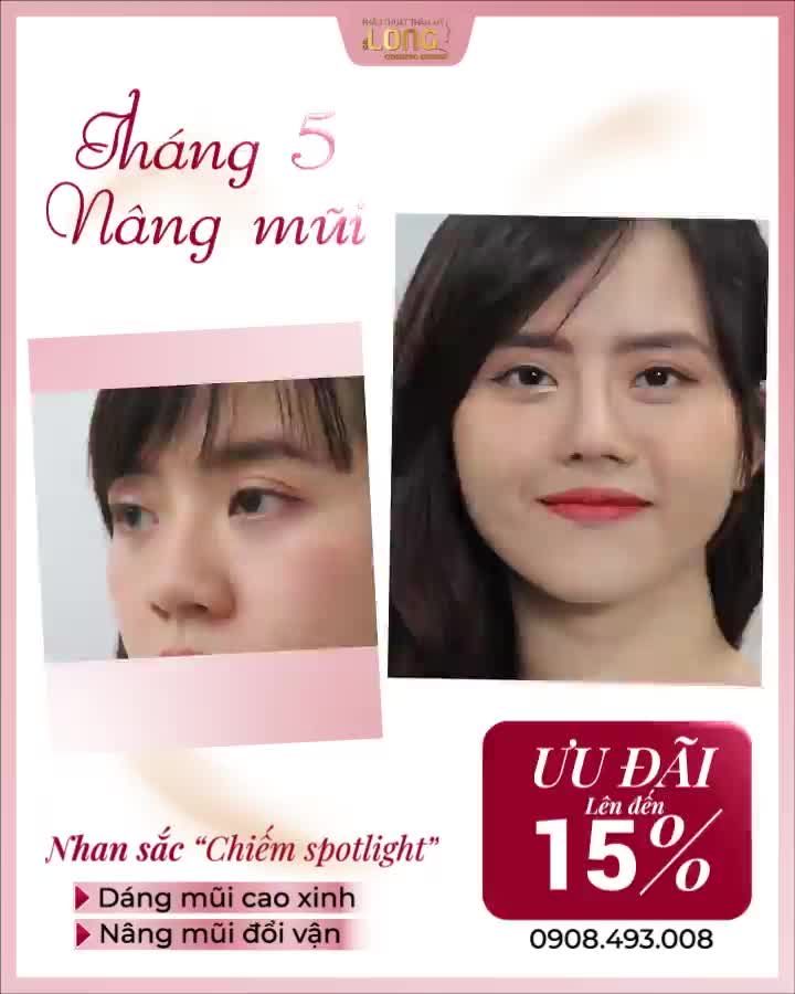 CHÀO THÁNG 5 RỰC RỠ - NÂNG MŨI SALE HẾT CỠ MŨI ĐẸP GIÁ TỐT  CHỐT NGAY TRONG THÁNG NÀY