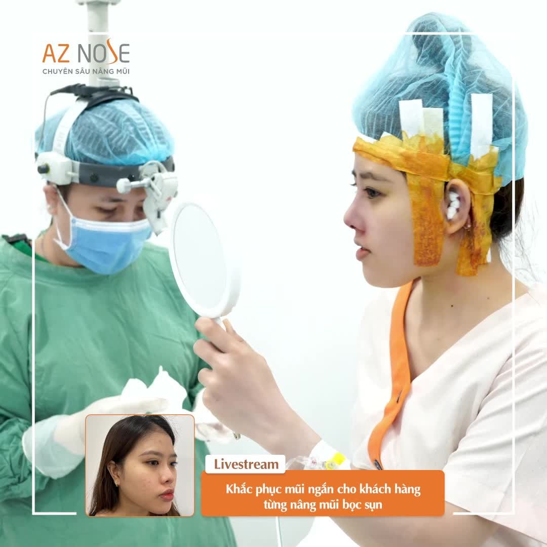 Cải thiện mũi ngắn, mặt g.ãy cho khách hàng 2K đến từ Đồng Nai
