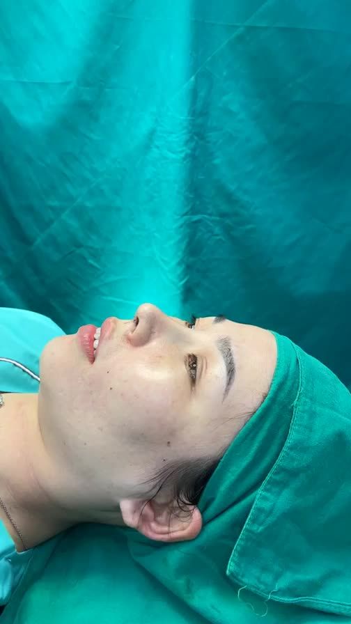 Case mũi cấu trúc vừa hoàn thành