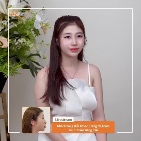 Khách hàng 2K3 đến từ Sóc Trăng cảm nhận như thế nào sau 1 tháng khắc phục mũi g.ồ, da mũi m.ỏng?