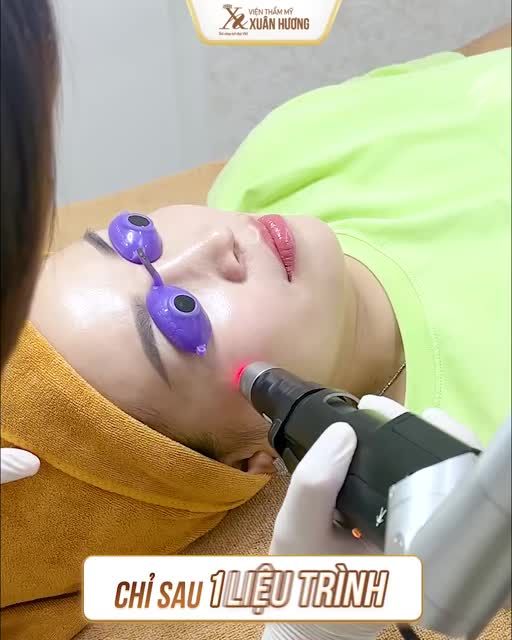 TRỊ NÁM THẾ NÀY MỚI GỌI LÀ ĐỈNH CAO CHỨ