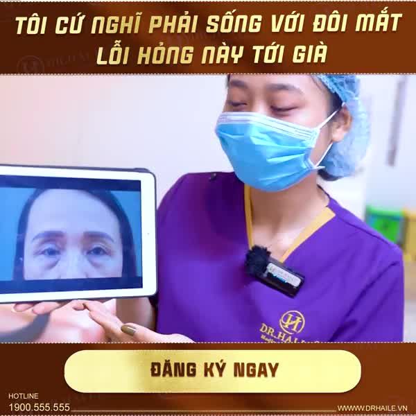 Mí lỗi hỏng làm vị khách hàng mất tự tin, stress, ngại tiếp xúc với tất cả mọi người. Đôi mắt luôn luôn gắn liền với chiếc kính râm -> "Có những lúc nghĩ mình sẽ sống chung với nếp mí lỗi, hỏng cả cuộc đời!"