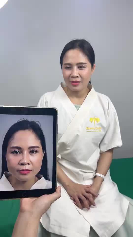 khách hàng đến tái khám Vline Perfect tại TMV Tấm.