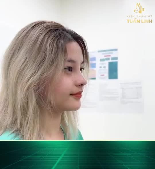 Angel Line tự nhiên - Dáng mũi được ưu chuộng nhất hiện nay => Click xem ngay CLIP bên dưới nha.