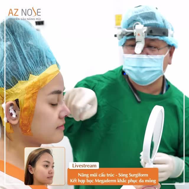 Khắc phục mũi thấp - ngắn với phương pháp nâng mũi cấu trúc - sóng Surgiform