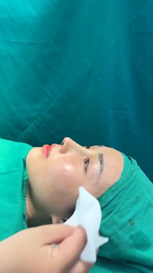 Case mũi cấu trúc vừa hoàn thành
