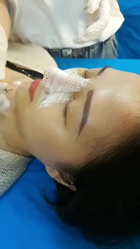 Hướng dẫn tháo nẹp mũi tại nhà