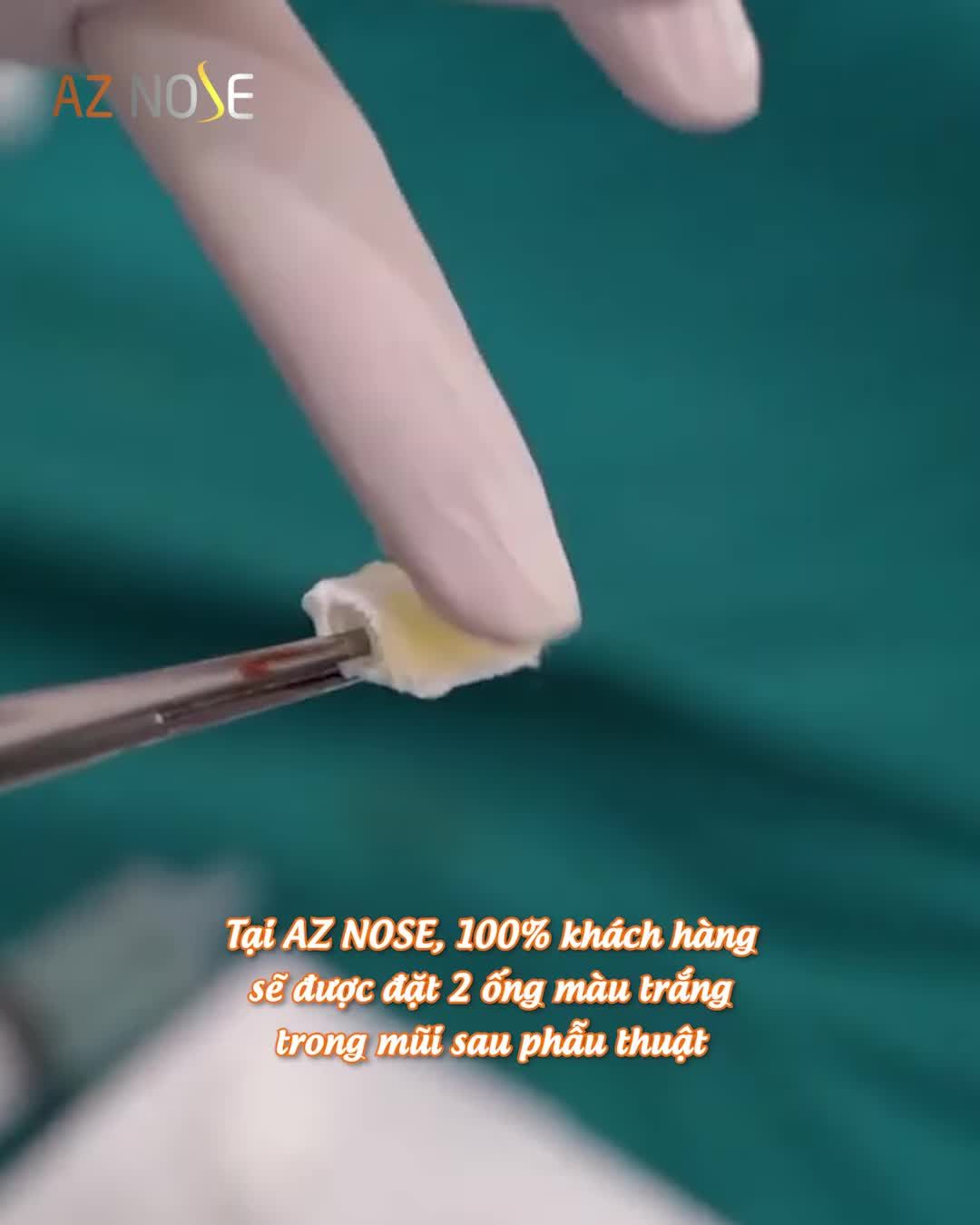 2 ống đặt trong mũi sau phẫu thuật có khó chịu “như lời đồn”?