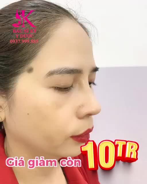 Tự tin khác biệt với dáng mũi ALINE cao thanh tú cùng với 3 tiêu chí quan trọng: