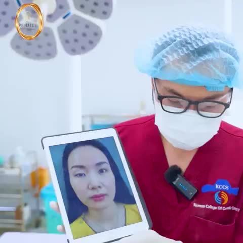 Qua bàn tay vàng của Th.S BS Hải Lê, đôi mắt của em gái đã khác biệt hoàn toàn: Nếp mí được tạo hình sắc nét, cơ nâng mi được căn chỉnh giúp cải thiện độ mở của mắt!
