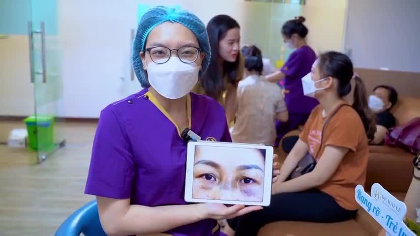 Hóa đôi mắt trẻ trung, xóa bỏ da chùng sụp mí chỉ sau 30 phút thực hiện Nâng cung mày tại Dr.Hải Lê