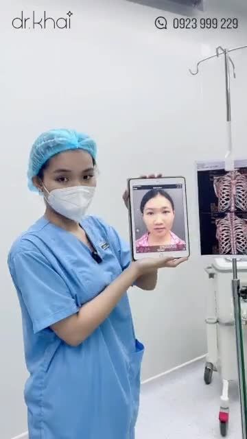 NÂNG MŨI CẤU TRÚC SỤN SƯỜN  TẠO GÓC MŨI - MÔI ĐẸP CHUẨN TỈ LỆ VÀNG