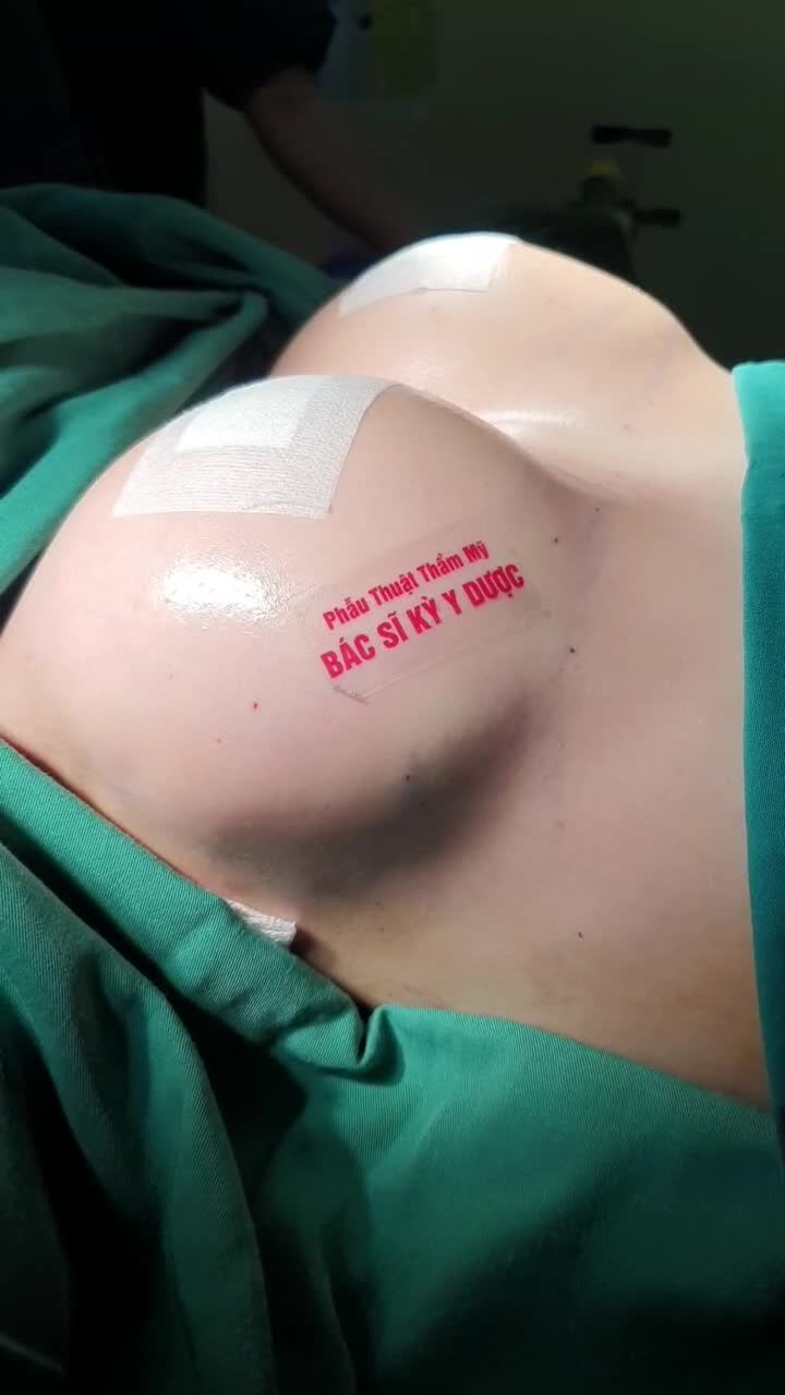 Sở hữu ngay Vòng 1 sexy trong mùa hè này.