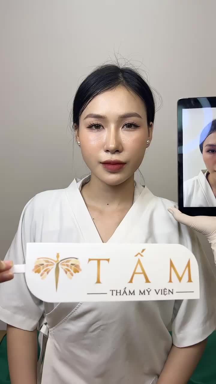 Ca cân chỉnh gương mặt nhờ Combo Filler má, cằm, môi tại Tấm