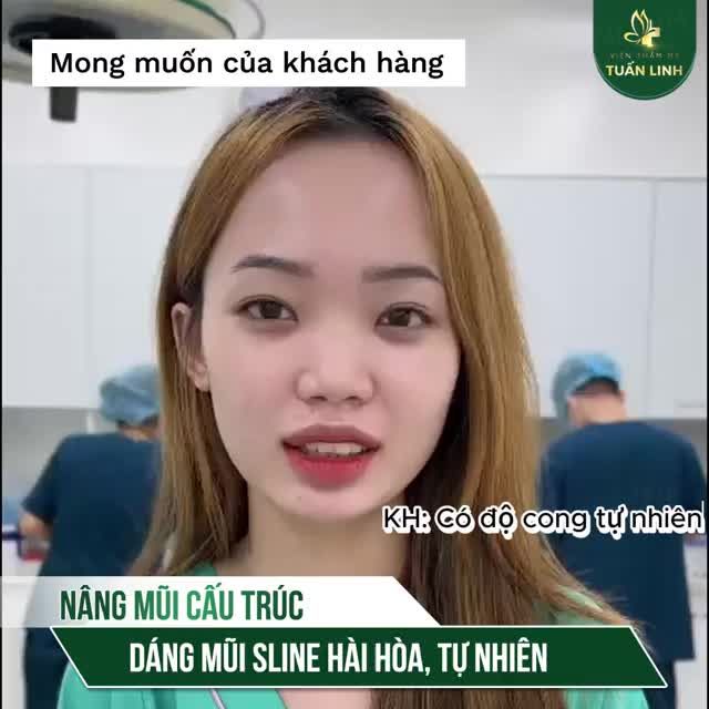 Dáng mũi Sline hài hòa, tự nhiên cho cô nàng có khuôn mặt nhỏ!