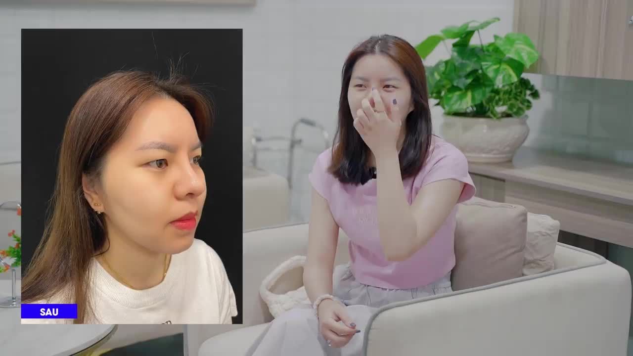 Chị Na (24 tuổi), từ Lào về Việt Nam làm đẹp dịch vụ Nâng mũi SVF. Chị mong muốn có dáng mũi mới với sóng và đầu mũi nâng cao hơn nhưng vẫn giữ được nét tự nhiên cho khuôn mặt.