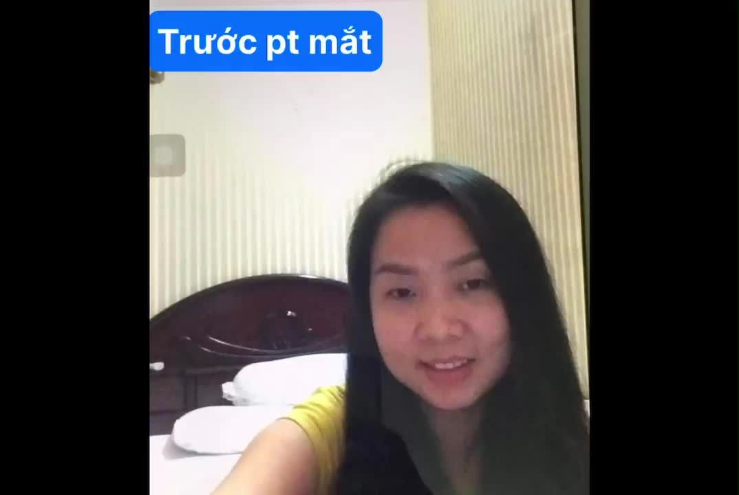 CẮT DA MỠ THỪA MI TRÊN GIẢI PHÁP CHO GƯƠNG MẶT THÊM HOÀN HẢO