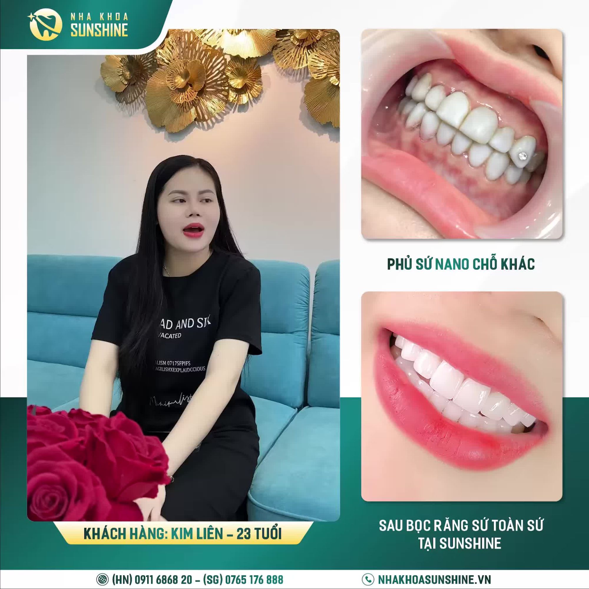 Với quảng cáo phương pháp không cần mài răng, chi phí rẻ “không tưởng” và có răng ăn nhai chỉ sau 1 giờ.