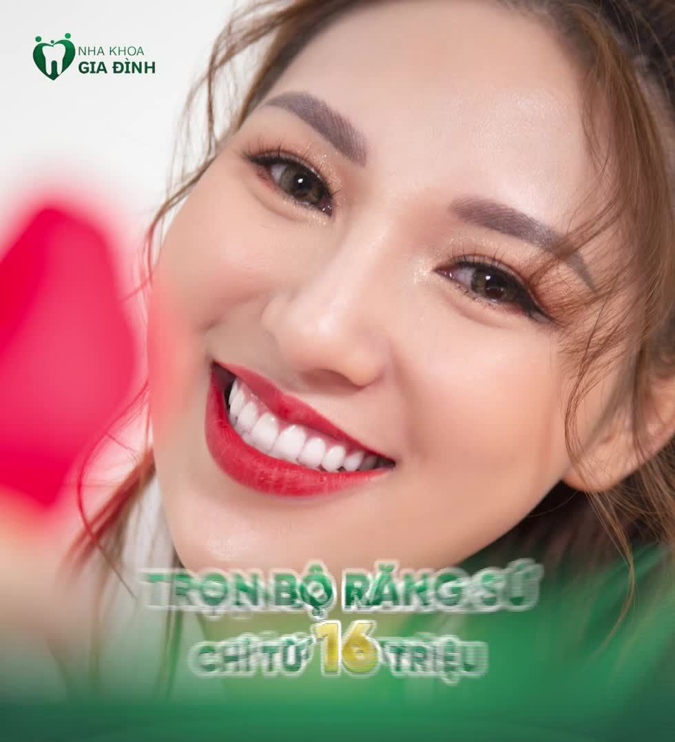 NHỮNG HÀM RĂNG CỰC XẤU ĐỂ TRỢ GIÁ CHỈ TỪ 16TR 16 RĂNG