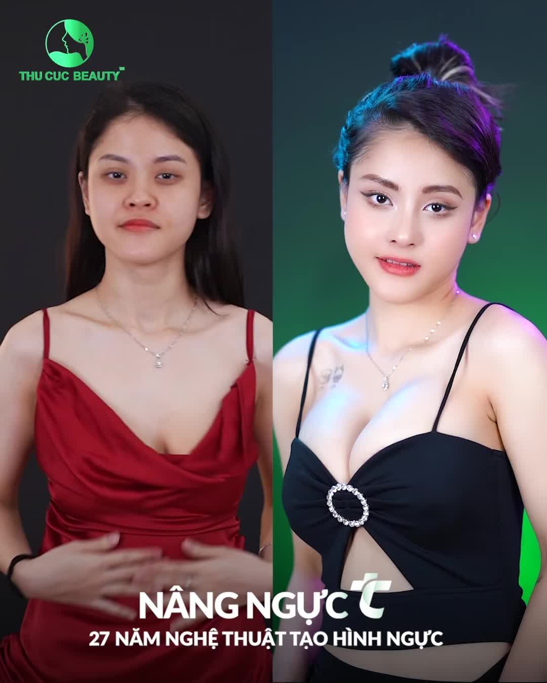 "XÓA TAN" Vòng 1 sa trễ chỉ sau 60P Ưu đãi lớn tại Thu Cúc