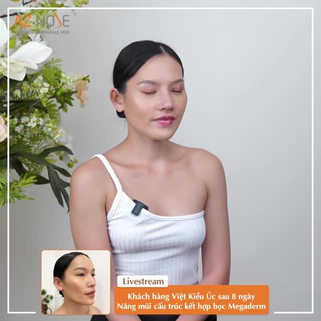 Khách hàng Việt Kiều Úc ưng ý với dáng mũi 8 ngày tuổi - thực hiện bởi bác sĩ CKI. Hoàng Nhung.