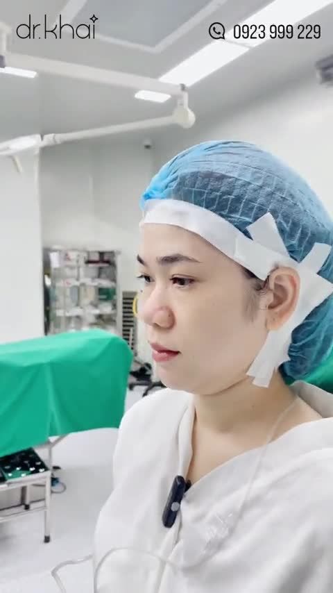 CÁNH MŨI TO - ĐẦU MŨI THẤP MŨI ĐẸP SAU 60 PHÚT - NÂNG MŨI AN TOÀN - HÀI HÒA VỚI GƯƠNG MẶT