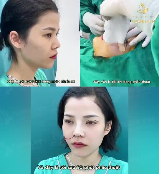 Hành trình 10 ngày thay đổi nhan sắc xinh đẹp trẻ trung hơn cho bạn gái đến từ Tiền Giang!!