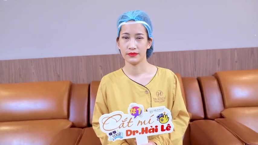Mí mắt vừa thực hiện xong tuy vẫn còn sưng nhưng đôi mắt đã toát lên được vẻ rạng rỡ tự nhiên