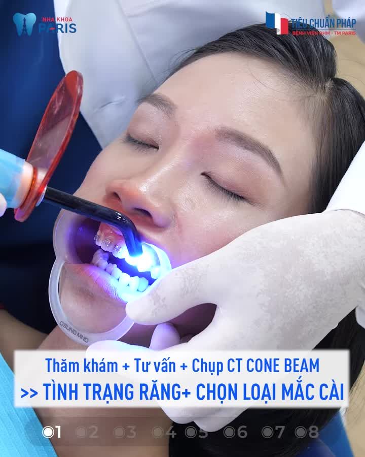 Quy Trình Niềng Răng Chuẩn Bệnh Viện RHM