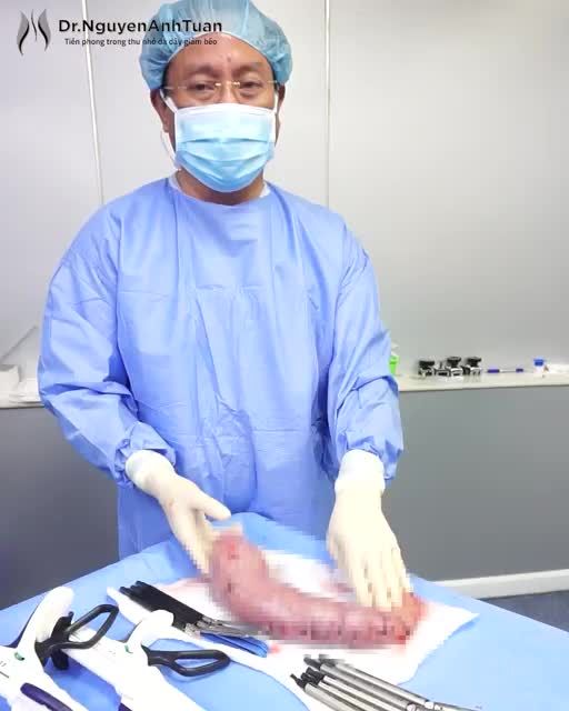 KÍCH THƯỚC DẠ DÀY SAU ĐẶT BÓNG TRÔNG NHƯ THẾ NÀO?