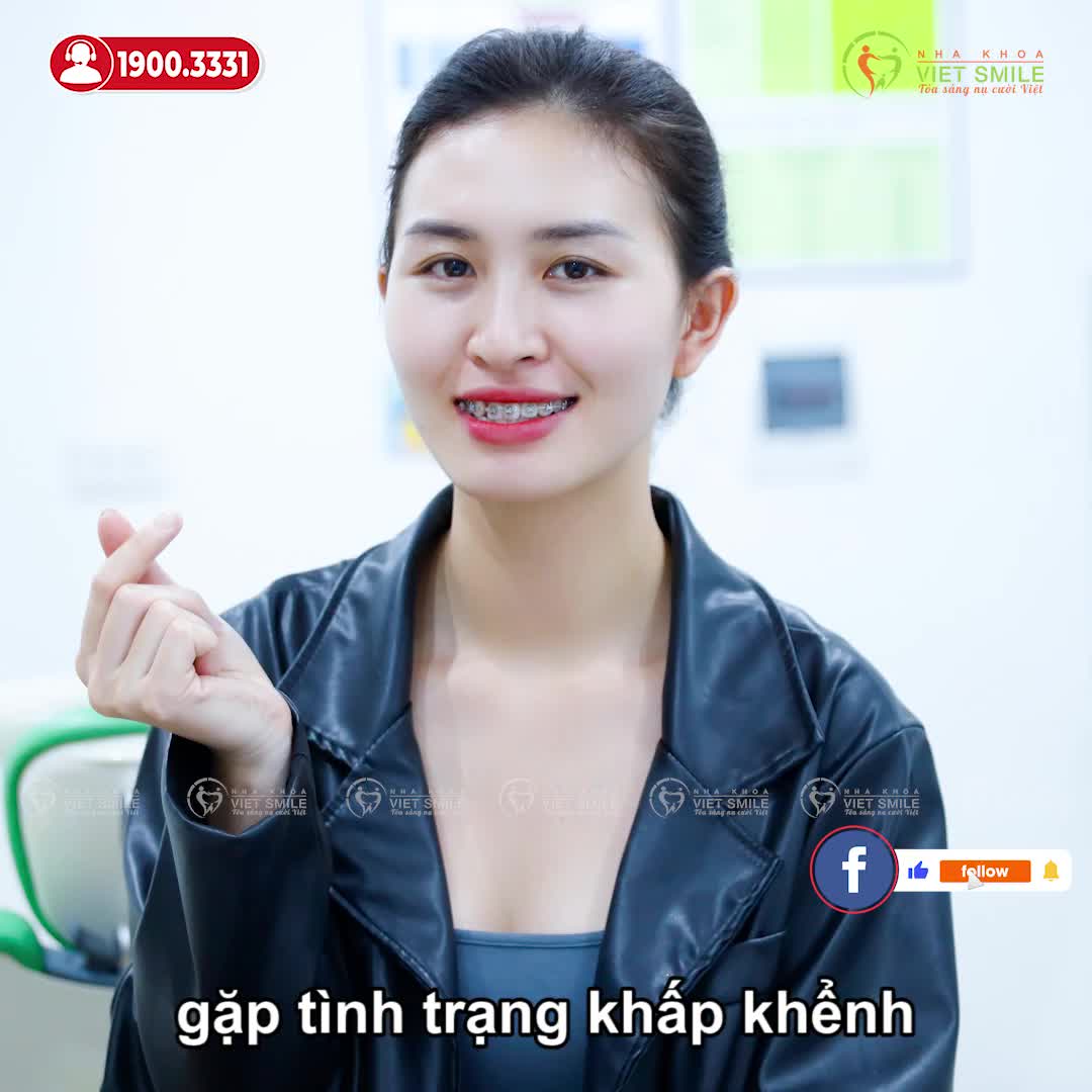 NIỀNG RĂNG CẢI THIỆN RĂNG KHẤP KHỂNH, LỆCH MẶT