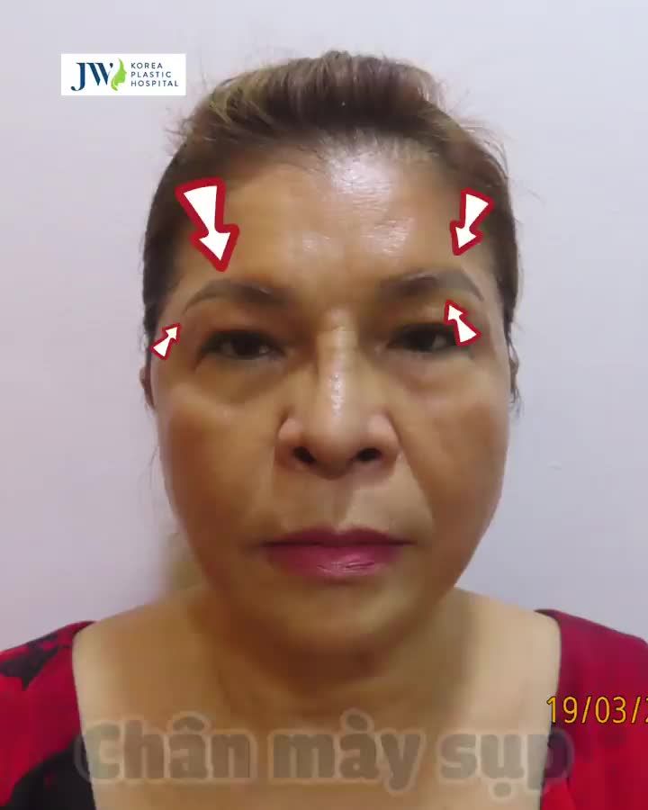 TIN ĐƯỢC KHÔNG: Quý bà U60 bỗng TRẺ ĐẸP 10 TUỔI khiến chồng HÚ HỒN