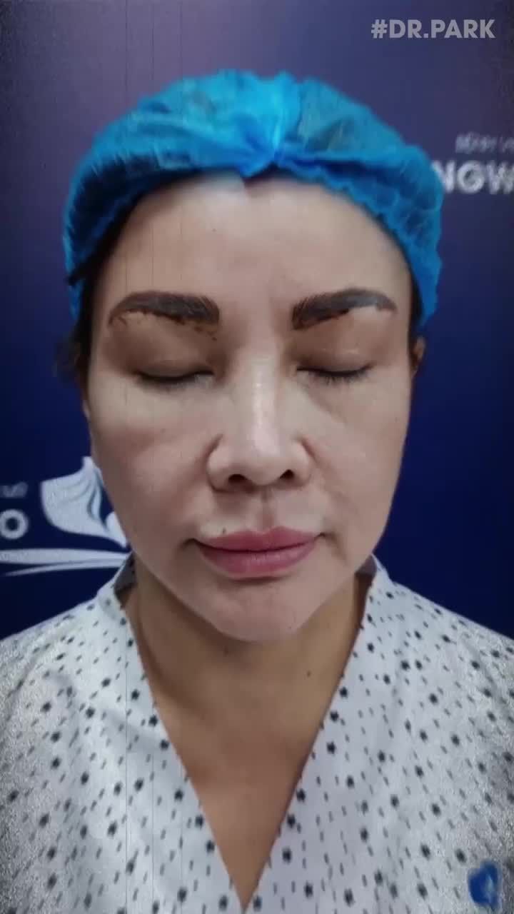 VÌ SAO CĂNG DA MẶT ĐƯỢC XEM LÀ BÍ QUYẾT HỒI SINH CỦA LÀN DA?