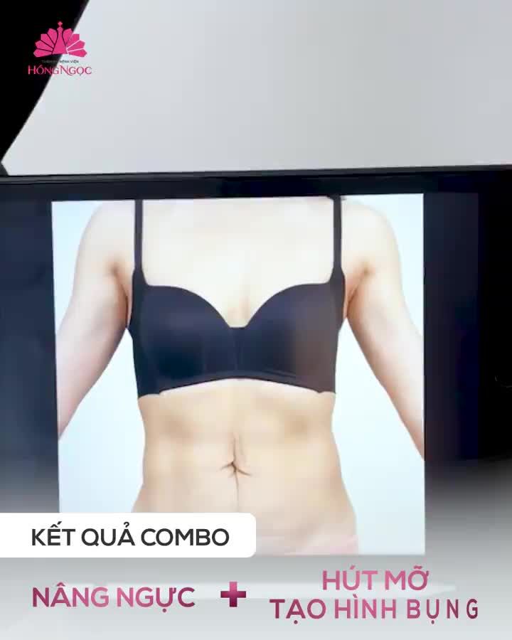 KẾT QUẢ "ĐỘ" BODY SIÊU ĐỈNH SAU 3 THÁNG NÂNG NGỰC + HÚT MO