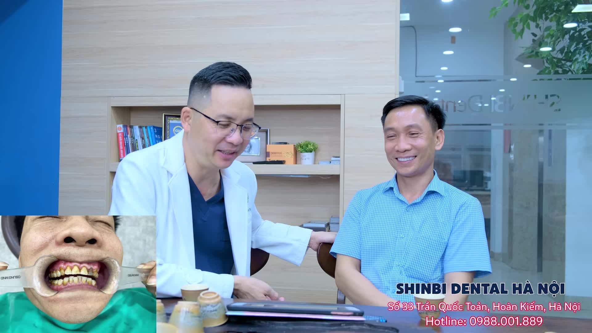 Anh Kiền tạm biệt hàm răng xỉn màu xấu xí đi theo năm tháng!