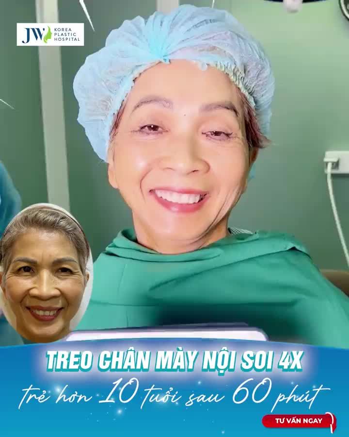 TRẺ ĐẸP HƠN 10 TUỔI SAU 60 PHÚT CHỈ VỚI TREO CHÂN MÀY NỘI SOI 4X