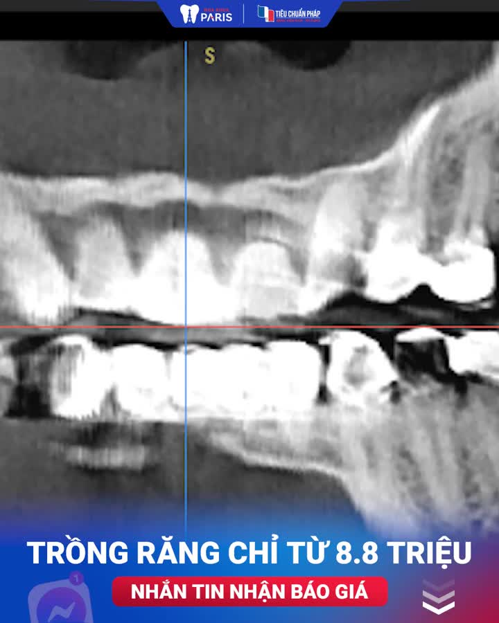 "Tôi làm nhiều nơi rồi, không có chỗ nào được như ở đây"