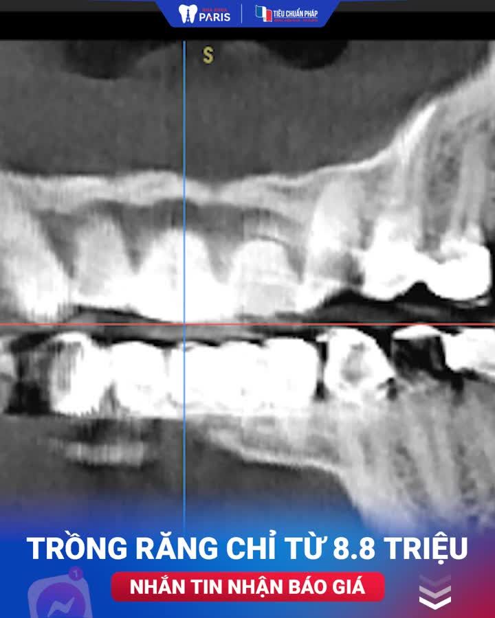 "Tôi làm nhiều nơi rồi, không có chỗ nào được như ở đây"