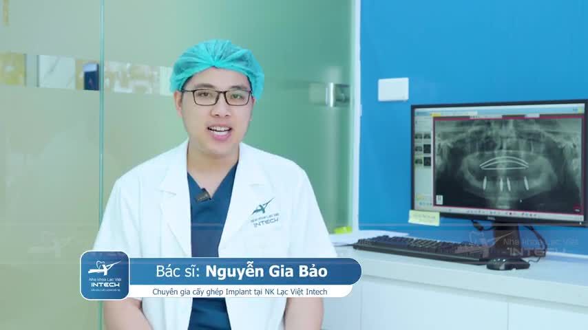 CẬN CẢNH LẮP RĂNG IMPLANT TOÀN HÀM: SO SÁNH PHỤC HÌNH BẮT VÍT VÀ PHỤC HÌNH XI MĂNG