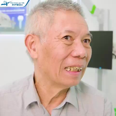 HÀNH TRÌNH NHỔ BỎ RĂNG TRỒNG IMPLANT TOÀN 2 HÀM ALL-ON-4