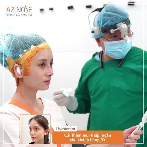 Dáng mũi Sline cao vừa cho khách hàng 9X có nền mũi thấp, ngắn