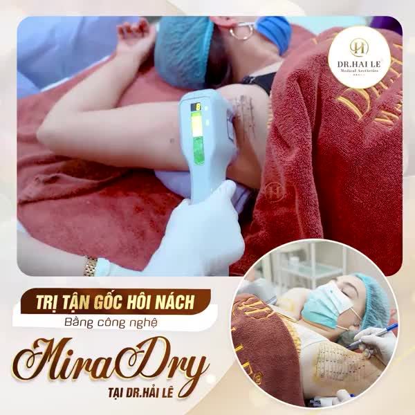 Chỉ một lần xài MiraDry, bạn có thể “giã từ ” với mùi hôi nách vĩnh viễn