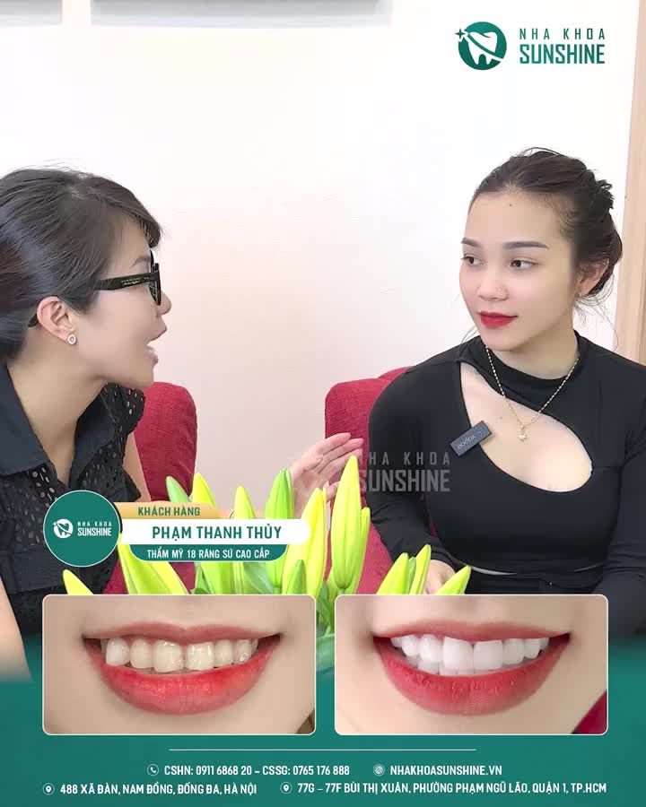LÀM RĂNG SỨ CHUẨN ĐẸP – KHÔNG ĐAU – AN TOÀN