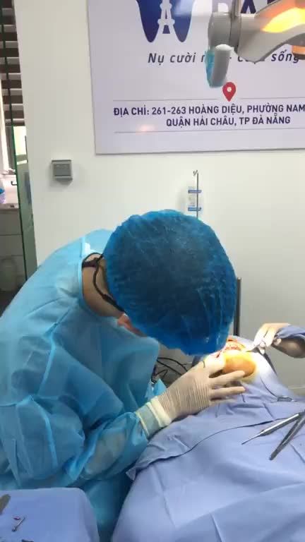 Quá trình cấy ghép implant trụ SIC thuỵ sĩ