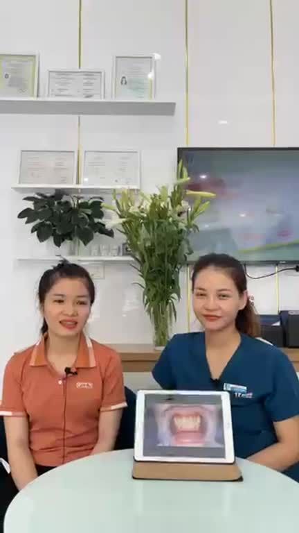 Tháo mắc cài sau 1 năm chỉnh nha tại nha khoa Paris Vinh