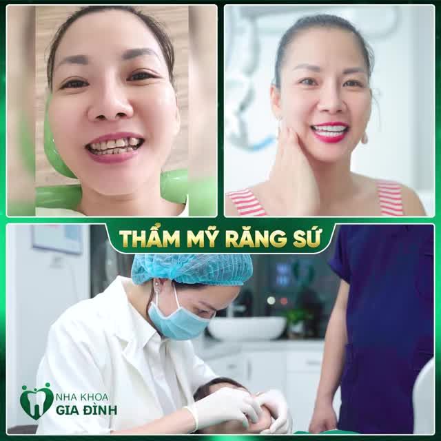 2 LẦN HẸN CÙNG CHUYÊN GIA - THẢ GA CƯỜI THOẢI MÁI