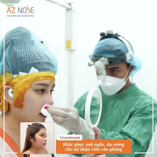 Khuôn mặt thay đổi bất ngờ sau khi nâng mũi cấu trúc