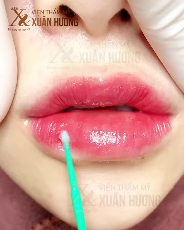 ĐÃ TÌM RA CÔNG NGHỆ CÓ THỂ GIÚP BẠN SỞ HỮU MÀU MÔI TRONG TRẺO THẾ NÀY